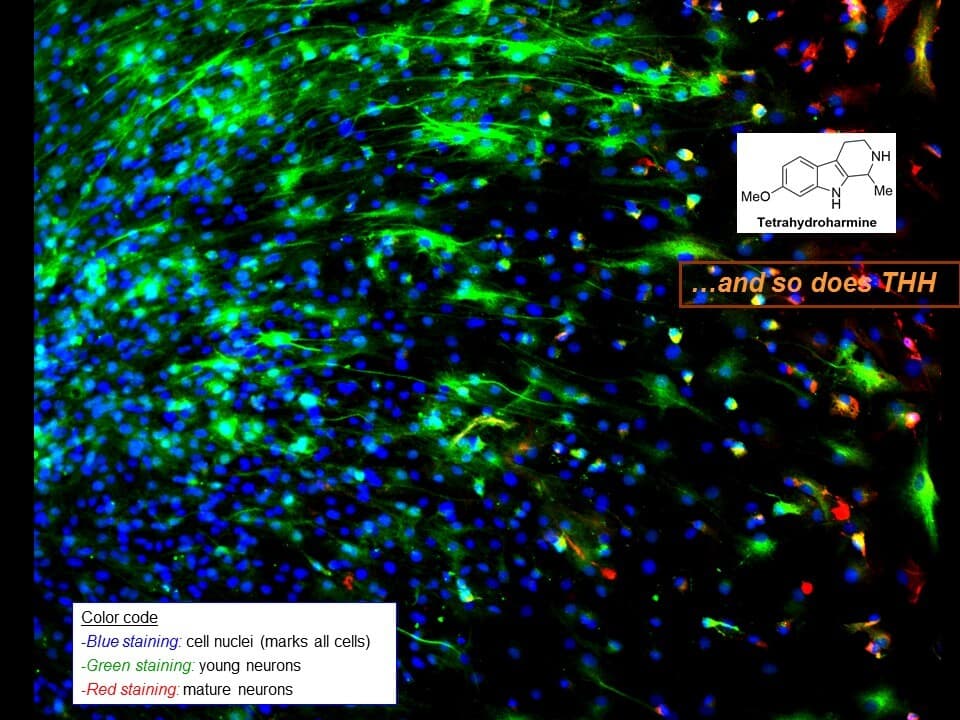 Ayahuasca brain cells