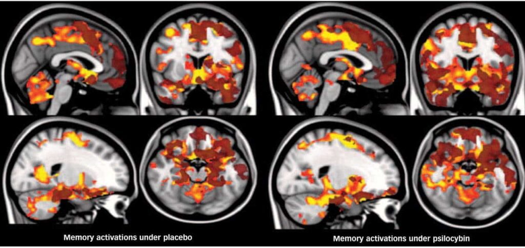 Brain scans show why psychedelics might be beneficial. These images appear in “Implications for psychedelic-assisted psychotherapy: functional magnetic resonance imaging study with psilocybin,” a 2012 study in the British Journal of Psychiatry. Early phase activations are shown in orange and late phase activations in translucent dark red. The left hemisphere is shown on the right. (Courtesy of Royal College of Psychiatrists)