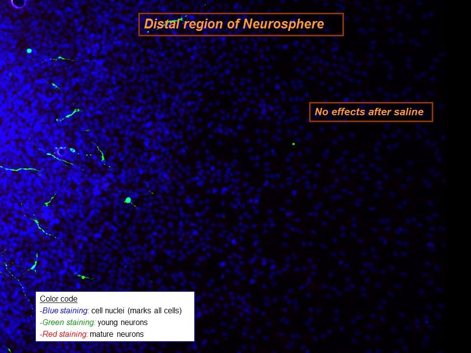 Ayahuasca brain cells